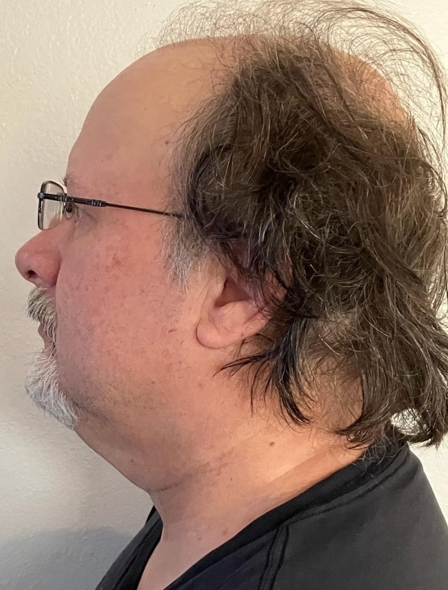 Mugshot Side